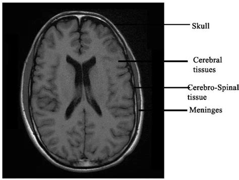 Axial Plane Of Human Brain Download Scientific Diagram