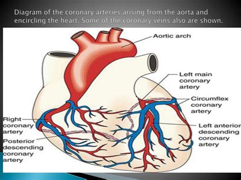 Coronary medical concept as a circular vein with gradual plaque formation resulting in clogged arteries and atherosclerosis. PPT - MYOCARDIAL INFARCTION PowerPoint Presentation - ID ...