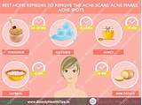 Acne Marks Treatment At Home Images