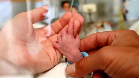 Smallest Preemies More Likely To Survive Without Complications