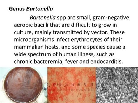Genus Bartonella Bartonella Spp Are Small Gram Negative Aerobic