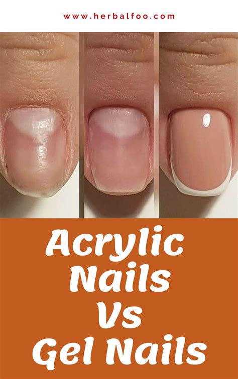Gel Nails Vs Acrylics Which Is The Best Choice In 2023