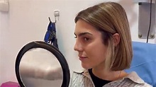 Anna Ferrer Padilla: el antes y el después de su nariz tras su ...