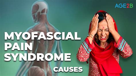 Myofascial Pain Syndrome Causes AGE B