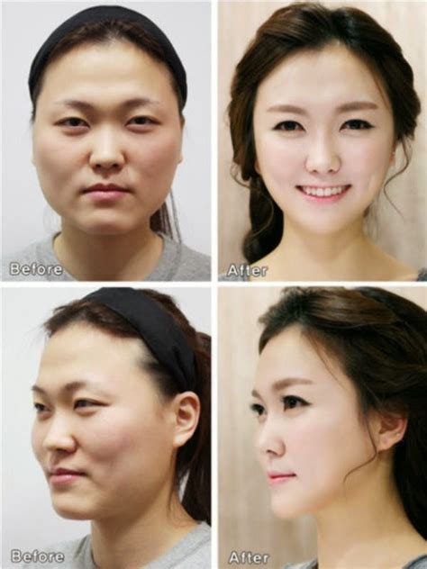 South Korea Plastic Surgery Tops Entertainment