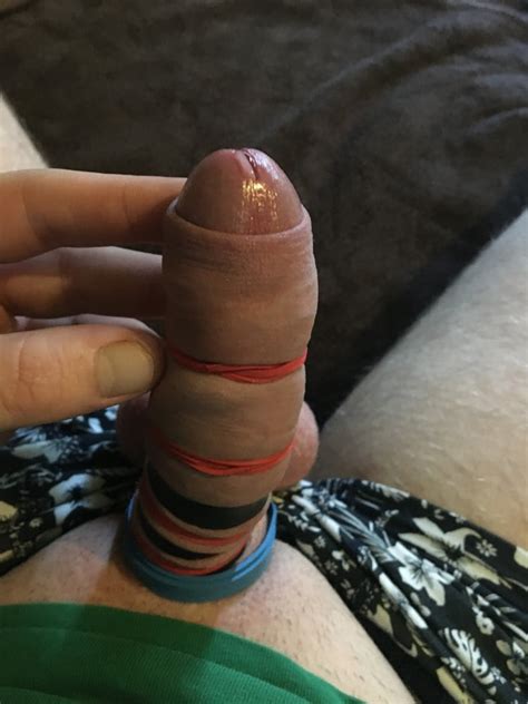 Cock And Ball Bondage With Rubber Bands And Cockrings 15 Pics Xhamster