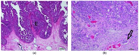 Histology Of Canine Transitional Cell Carcinoma Specimens A