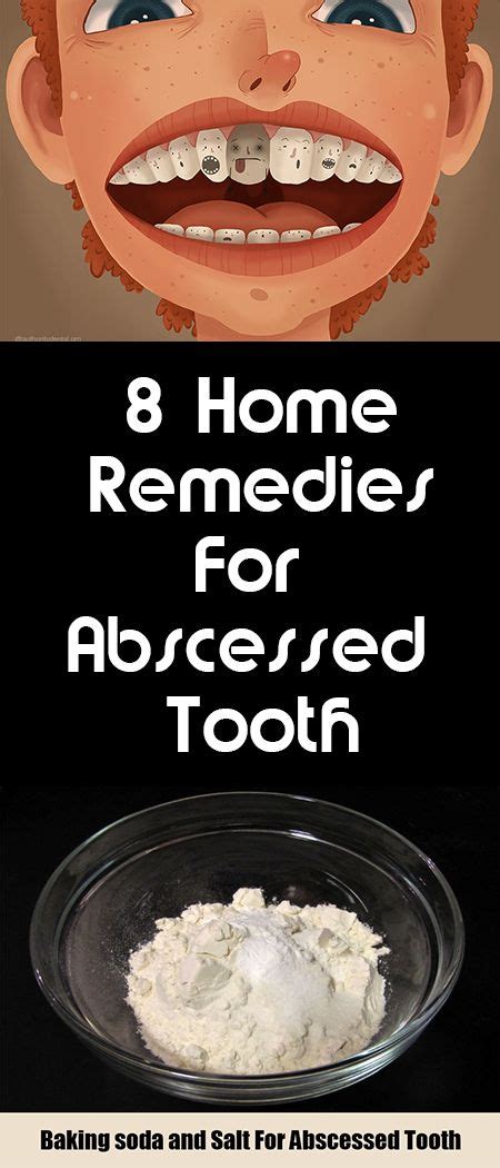 8 Home Remedies For Abscessed Tooth Boil Remedies Home Remedies