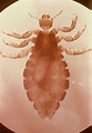 Lice | Public Health and Medical Entomology | Purdue | Biology ...
