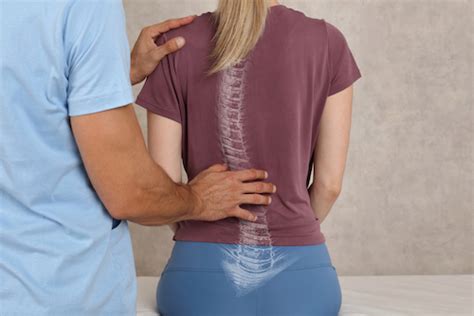 Physical Therapy For Scoliosis In Brighton