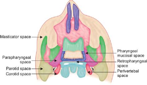 Figure 3 From Imaging Of Parapharyngeal Space And Infratemporal Fossa