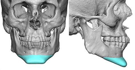 Ideal Chin Proportions For Men The Magnum Guide Magnum Workshop