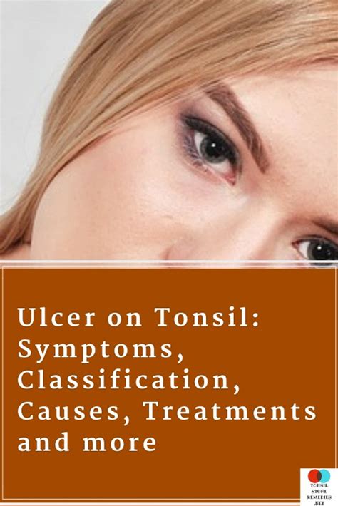 Ulcer On Tonsil Symptoms Classification Causes Treatments And More