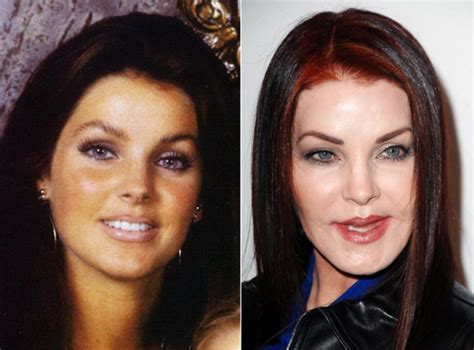 Priscilla Presley Before And After