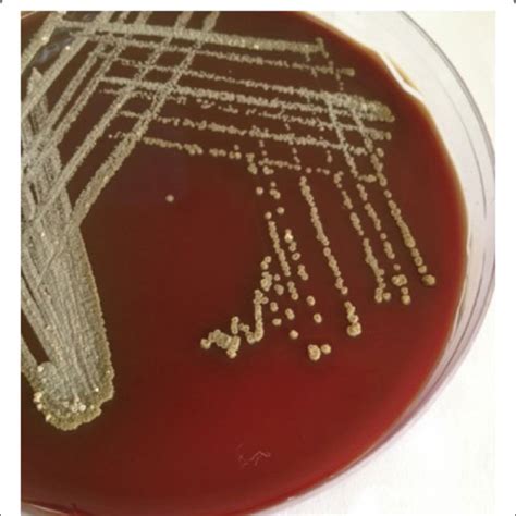 Gram Stain Gram Positive Branching Filamentous Bacteria Suggestive