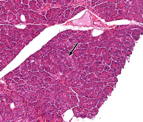 Liver Gallbladder And Pancreas Histology