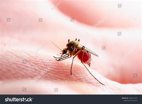 Dangerous Zika Infected Mosquito Skin Bite Stock Photo 1458311672
