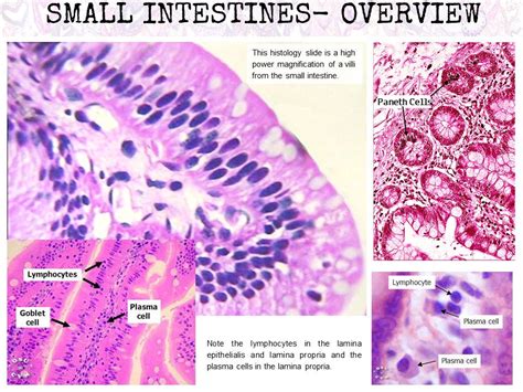 A Histology Tour Of The Gi Tract Small Intestines Overview Hot Sex Picture