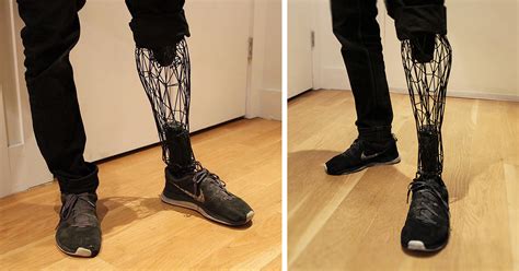 Incredible See Through Prosthetics 3d Printed From Titanium Bored Panda