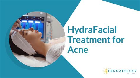 Hydrafacial Treatment For Acne Youtube