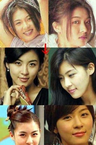 Ha Ji Won Facelift Plastic Surgery Before And After Star Hot Sex Picture