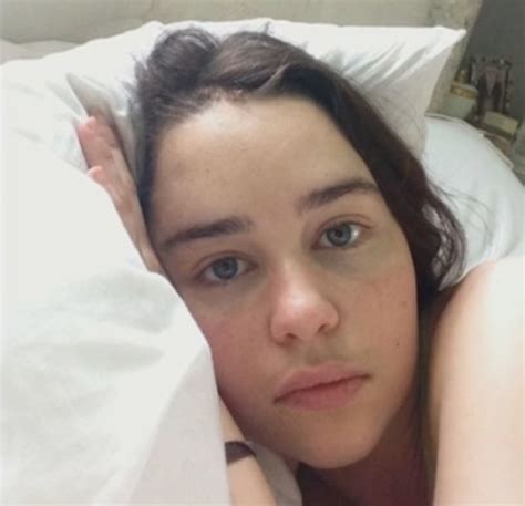 Game Of Thrones Emilia Clarke Shares First Hospital Photos From Brain
