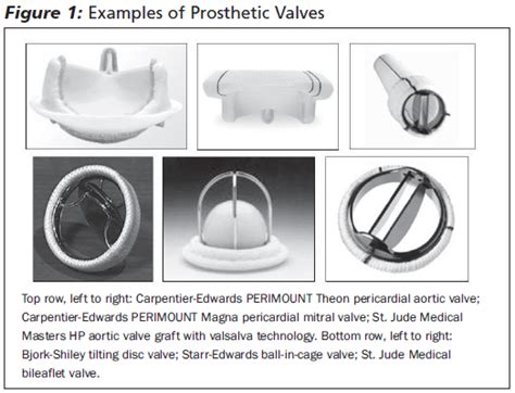 Complications Of Prosthetic Heart Valves In The Emergency Department