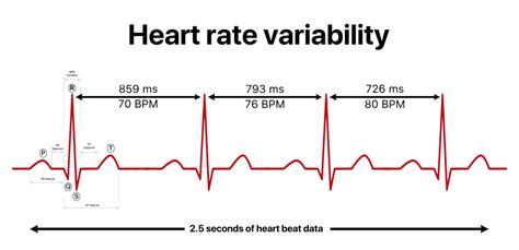Heart Rate Variability Wikipedia