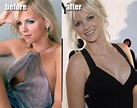 Anna Faris plastic surgery before and after