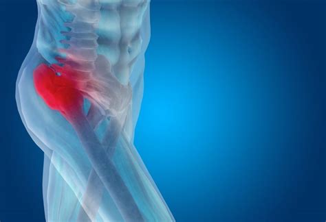Chiropractor Helps Relieve Hip Pain Comprehensive Spine And Sports Center