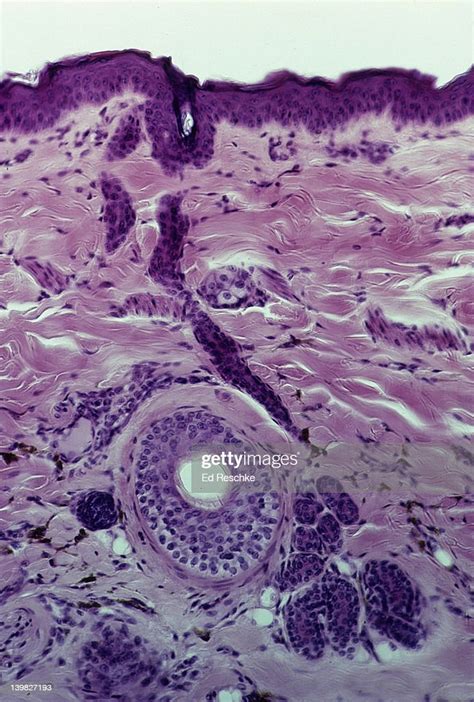 Sweat Gland Duct On Human Scalp Leading To Surface Crosssection Of A