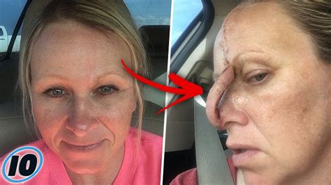 Women Left With Hole In Her Nose From Tanning Youtube