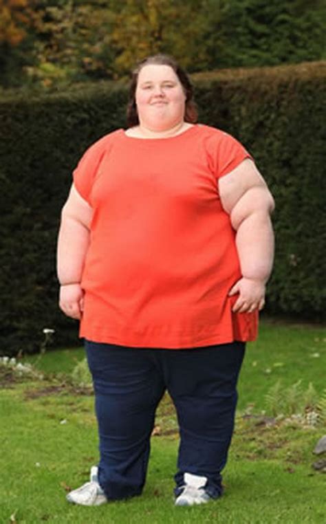 Britains Fattest Teen Loses Three Stone In 10 Days After Humiliation
