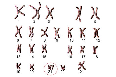 Karyogramm Chromosomenanalyse • Störungen Erkennen