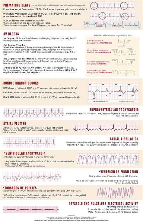 Cardiac Rhythms Cheat Sheet For Nursing Students Medical School Stuff