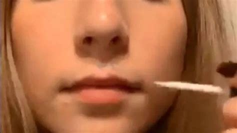 Health Experts Warn Against New Beauty Trend Of Glueing Top Lip To Skin