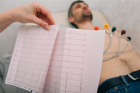 Badania EKG elektrokardiografia na czym polegają wskazania