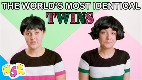 The Worlds Most Identical Twins A Dinky Doc Youtube