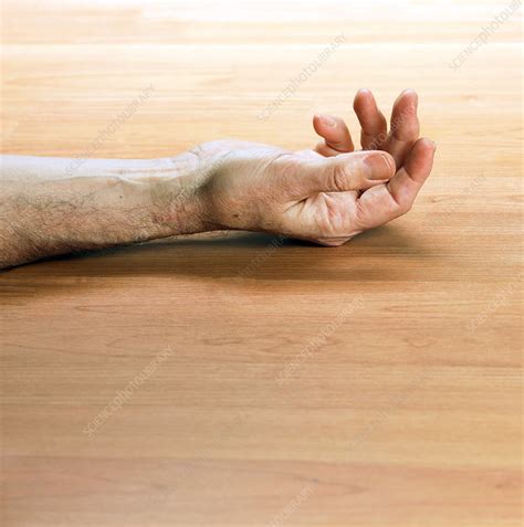 Man S Arm Laying On A Floor Stock Image M Science Photo