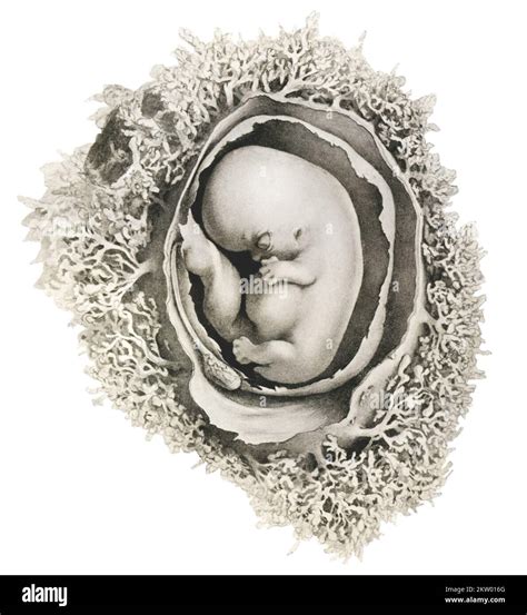 Human Embryo At 6 Weeks Illustration Stock Photo Alamy