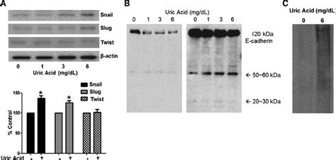 Effect Of Uric Acid On The Expression Of Snail Slug Twist And