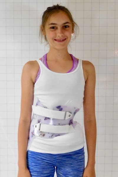 Cheneau Gensingen Brace Scoliosis Brace Tlso Cheneau Brace