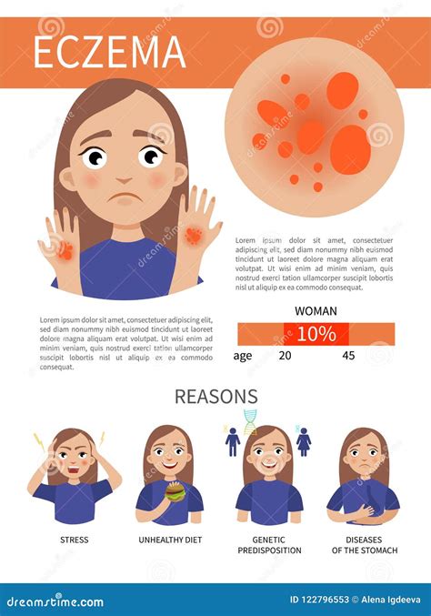 Skin Infographic Stock Vector Illustration Of Eczema 122796553