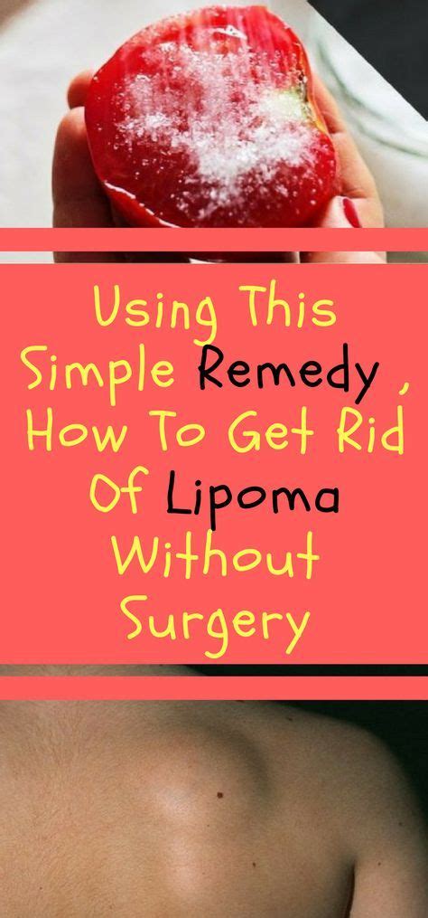 Using This Simple Remedy How To Get Rid Of Lipoma Without Surgery