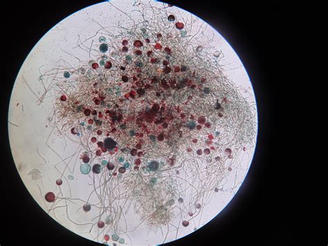 Rhizopus Sporangium Under Hpo Stereo Microscope Imkristine Flickr