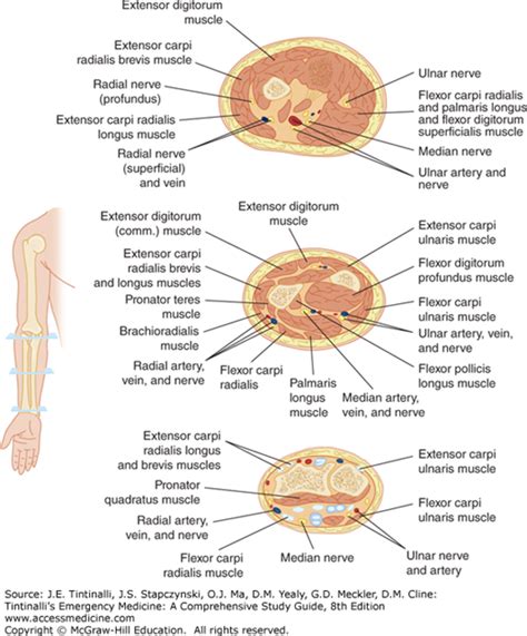 With compartment syndrome, compartment refers to separate sections of the body that contain muscles, nerves, and blood vessels. Compartment Syndrome | Anesthesia Key