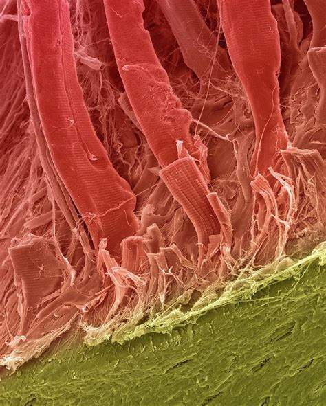 Tendons Attached To Bone Surface Photograph By Dennis Kunkel Microscopy