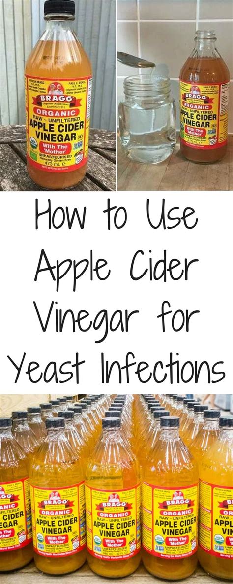 How To Use Apple Cider Vinegar For Yeast Infections Yeastinfection