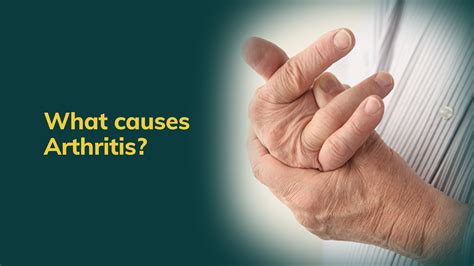 What Is Arthritis What Causes Arthritis Arthritis Arthritis Causes