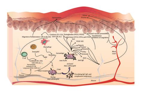 Pathophysiology Of Urticaria In Csu Patients Stimulation Of Mast